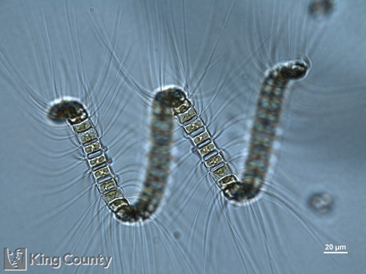 Photo of Chaetoceros debilis